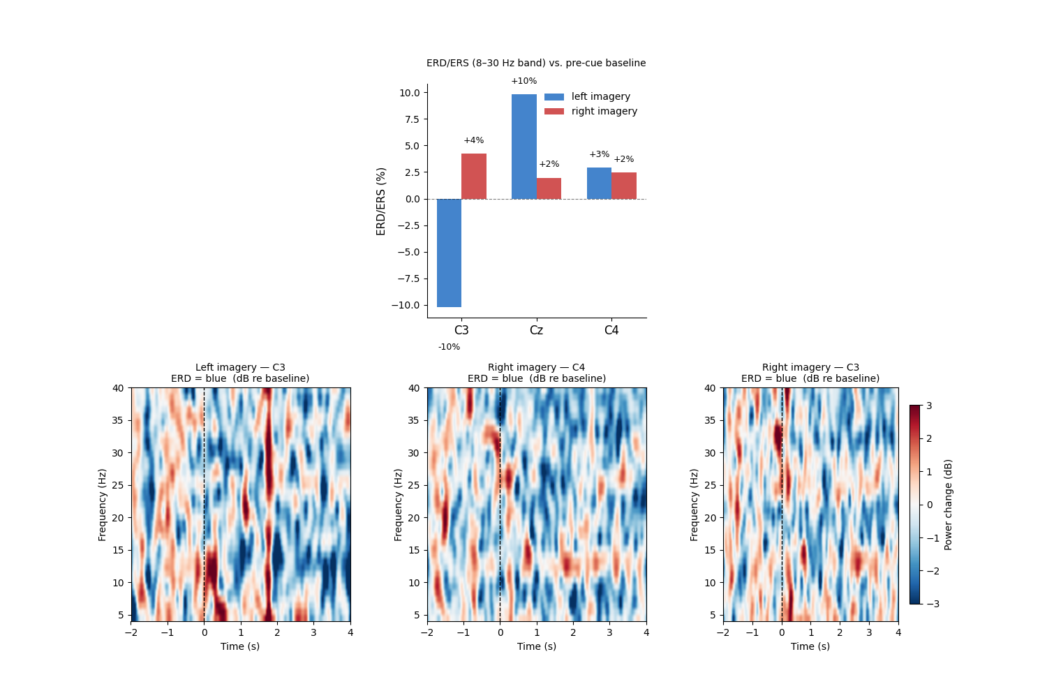 ERD/ERS (8–30 Hz band) vs. pre-cue baseline , Left imagery — C3 ERD = blue  (dB re baseline), Right imagery — C4 ERD = blue  (dB re baseline), Right imagery — C3 ERD = blue  (dB re baseline)